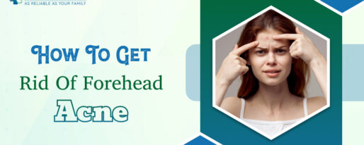 How To Get Rid Of Forehead Acne