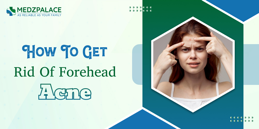 How To Get Rid Of Forehead Acne