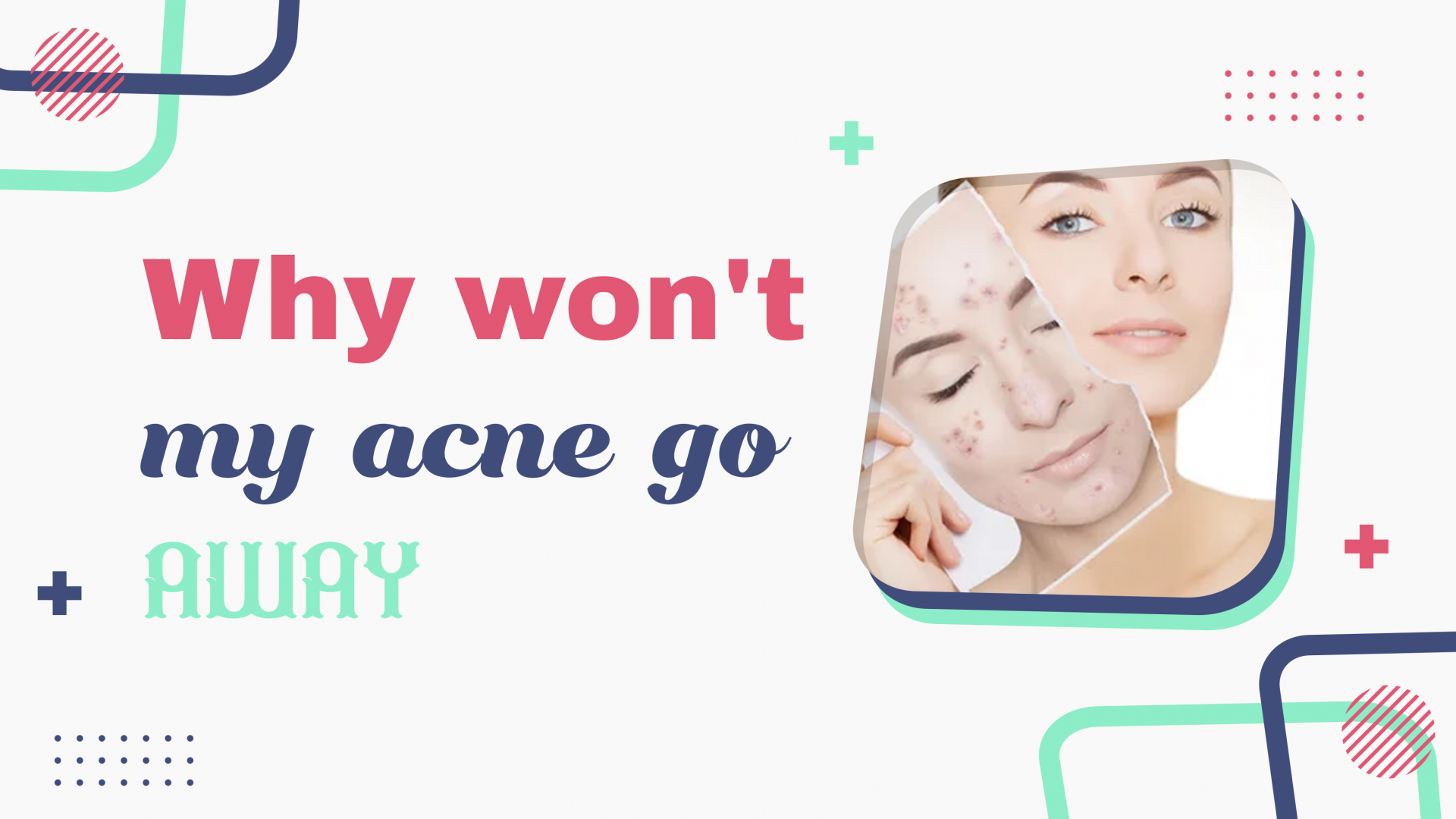 Your acne won't go away Best acne Treatments Medzpalace